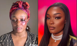 Gabon : L&Rsquo;Artiste Shan&Rsquo;L Victime De Violences Conjugales (Video)